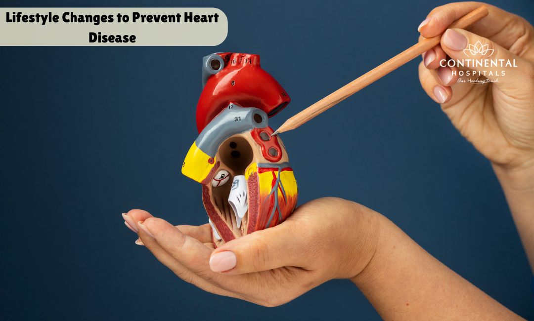 How To Prevent Heart Disease With Lifestyle Modifications